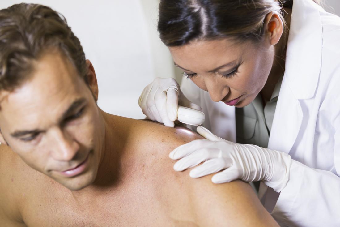 Dermatologist looks at patient's back