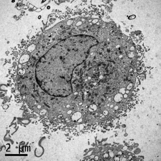 Mast cell