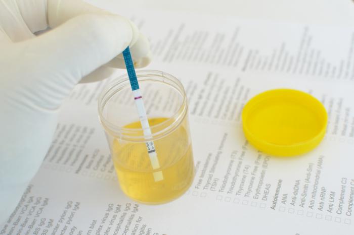 urine
sample