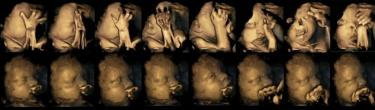 4D ultrasounds