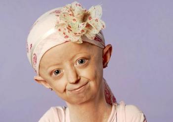 progeria adult