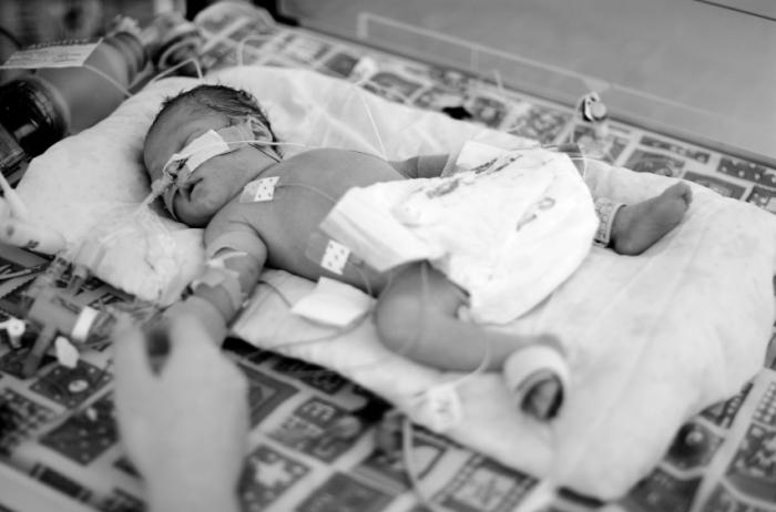 Preterm baby