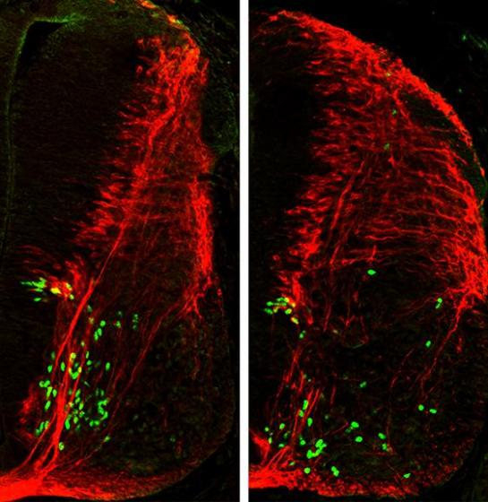 Nerve Cells