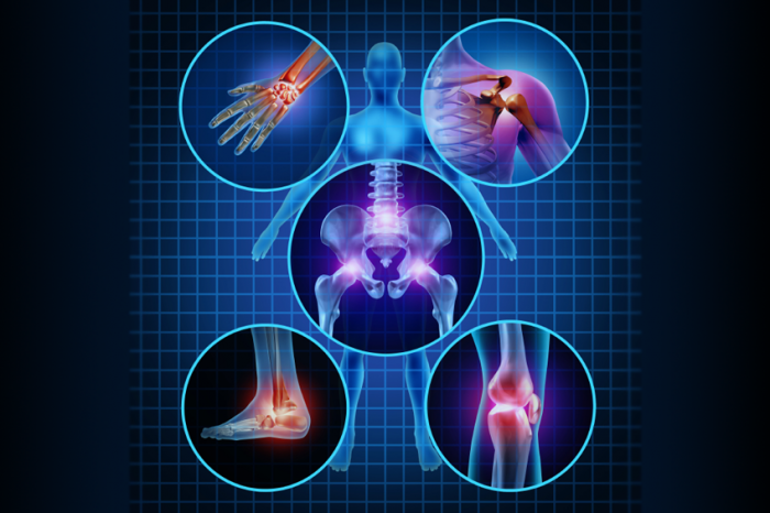 arthritis symptoms causes