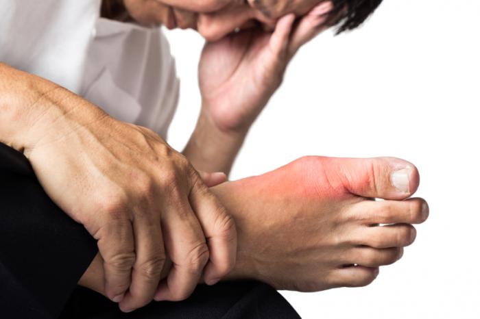 man with severe gout