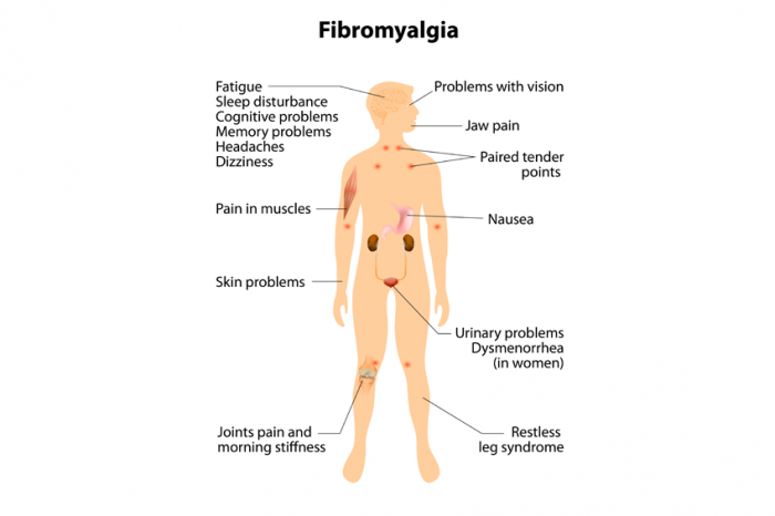 arthritis symptoms and treatments)