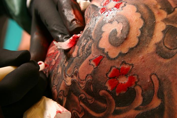 Tattoos may cause years of infection, itching and swelling