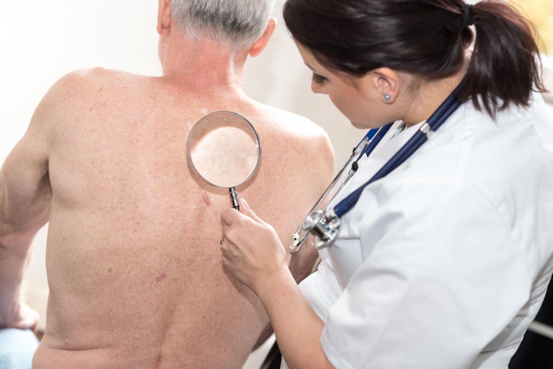 Female dermatologist inspecting skin on senior mans back.
