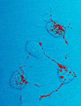Prion Trafficking: Scrapie Mouse