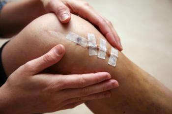 wound from knee surgery
