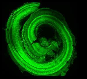 New Findings Hint toward Reversing Hearing Loss