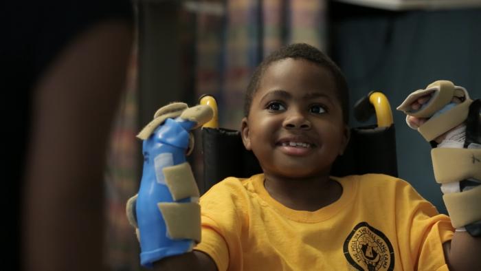 Zion Harvey after his bilateral hand transplant.