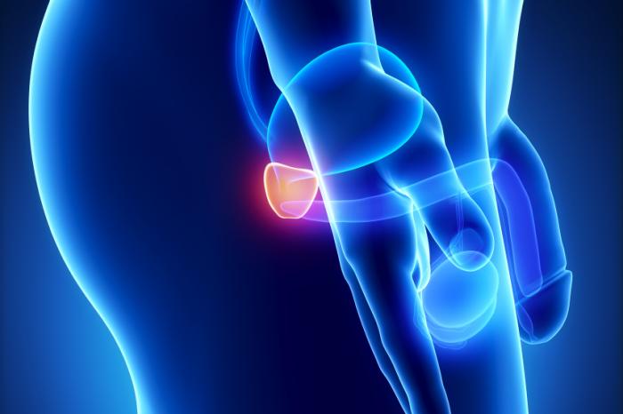 Prostate cancer only affects men and targets the prostate gland.