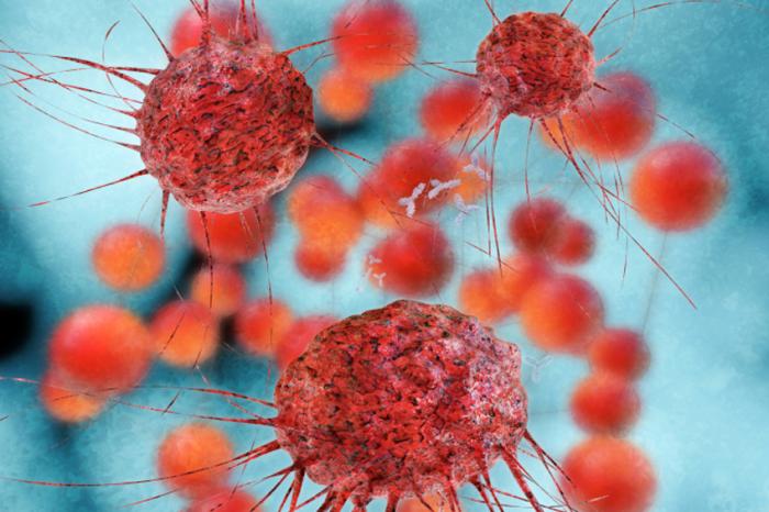 Breast cancer cells