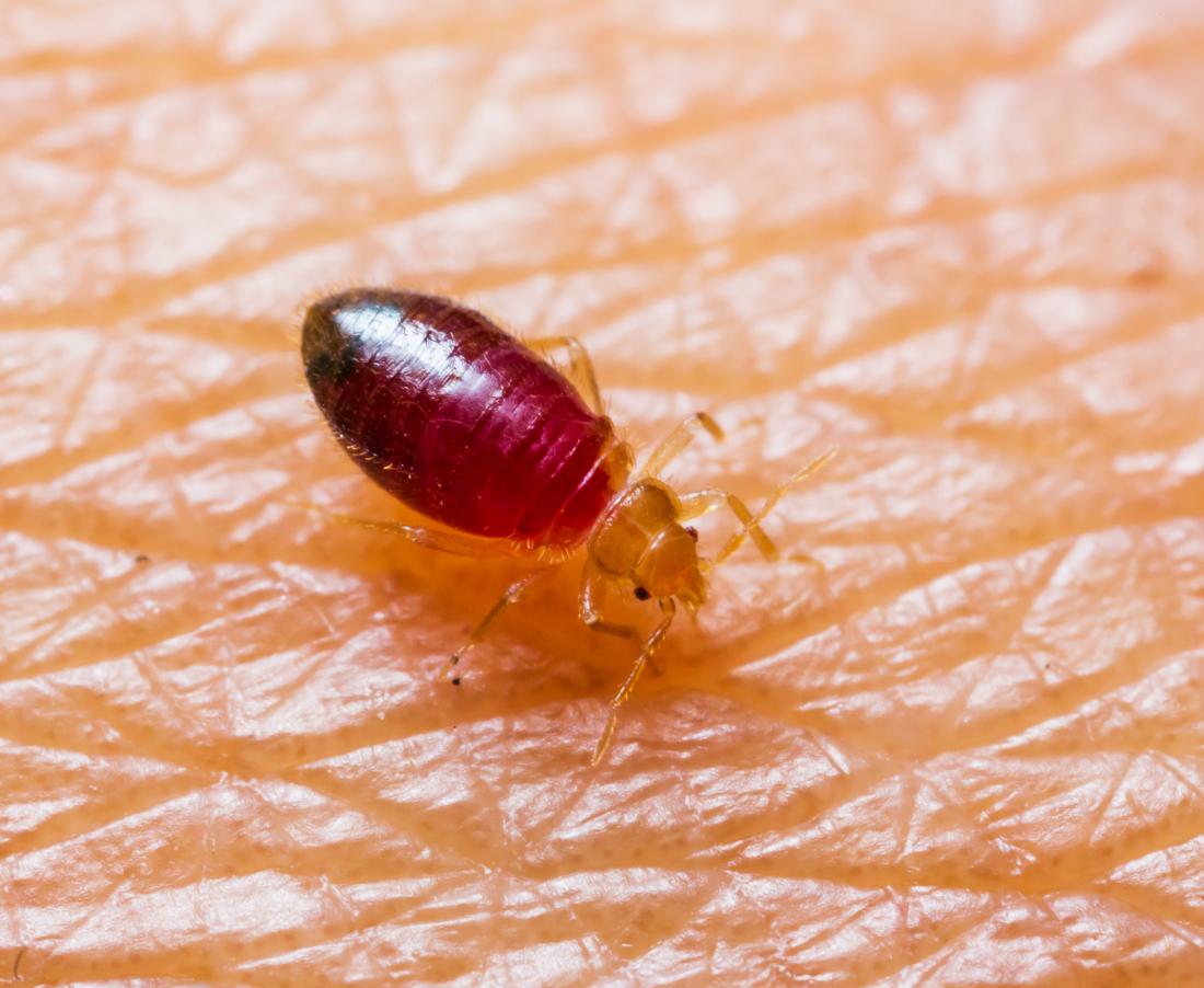 Getting rid of bed bugs: Natural measures, chemicals, and pest control