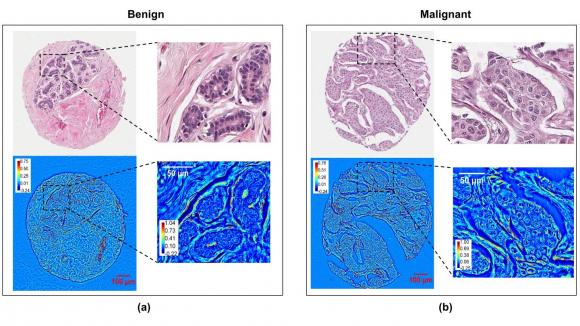 Comparison of Stained and Unstained Images in Breast Cancer Diagnosis