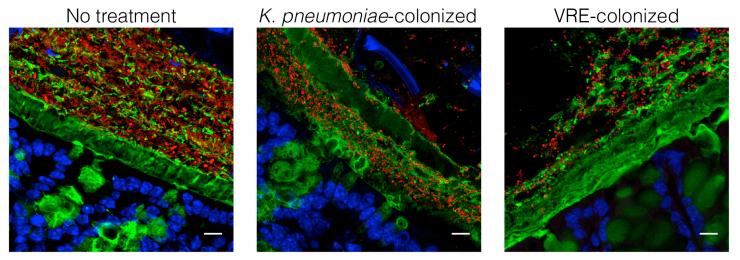 Images of lab bacteria