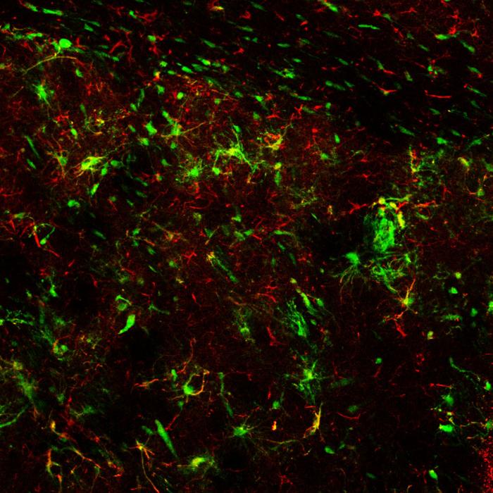 stem cells in DLB