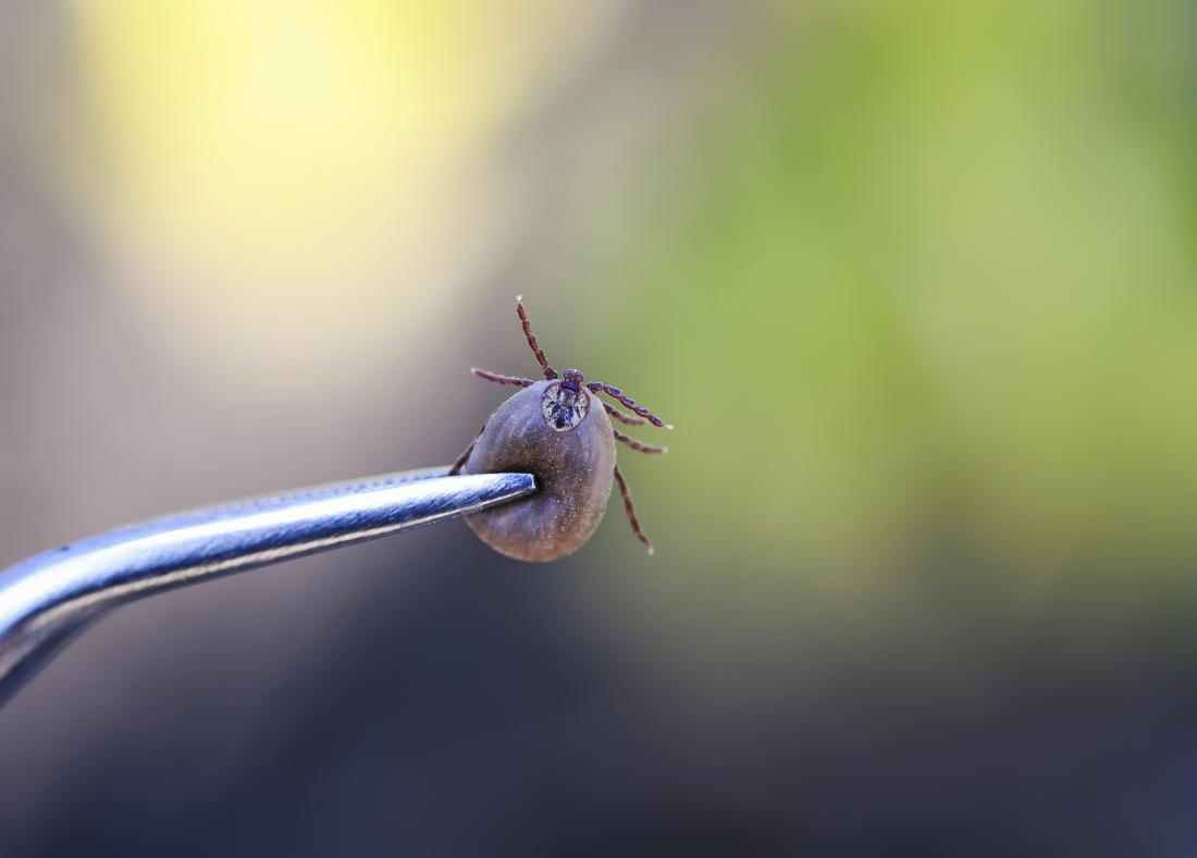 Tick removal: Tips, prevention, and checking