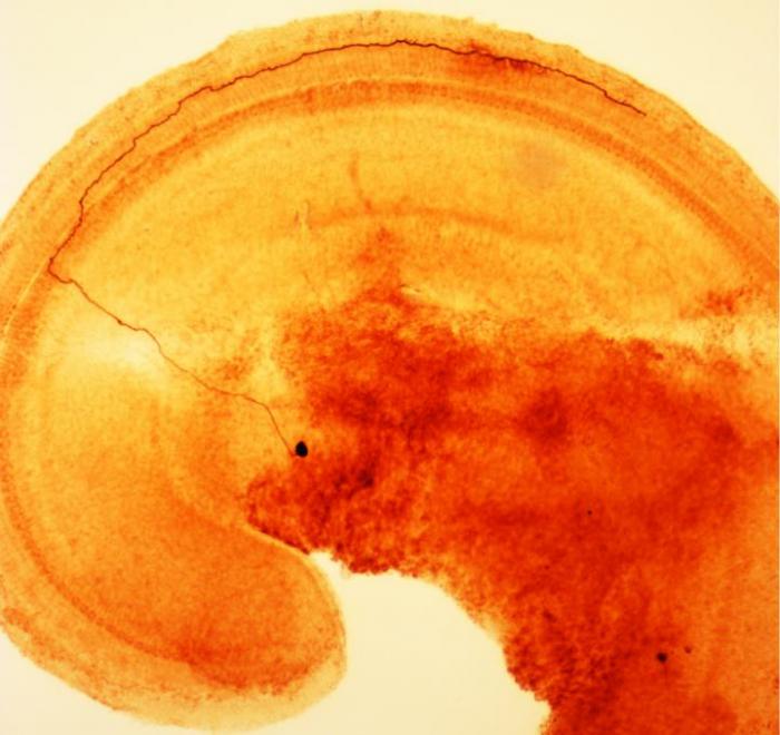 Inner Ear Nerve Cells Warn Brain of Damage