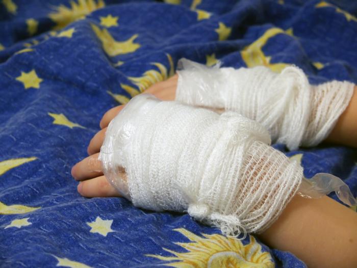 Two bandaged hands on top of a duvet.