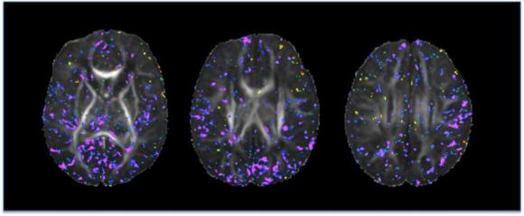 Newborn Brain Images