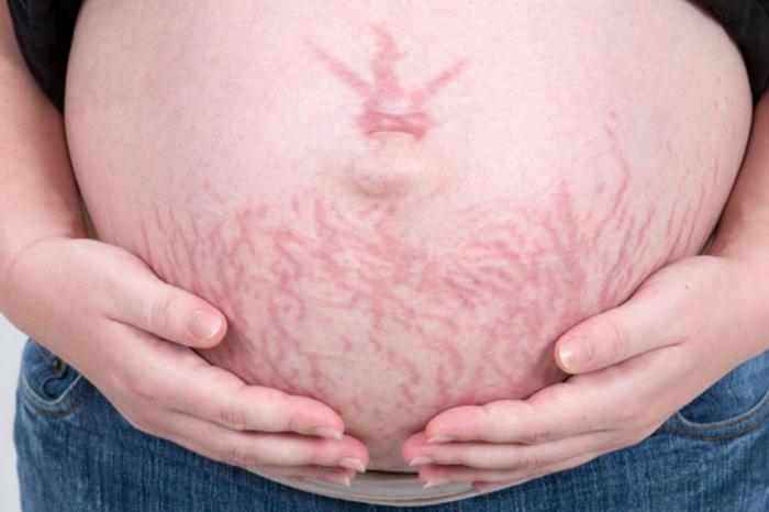 21 Weeks Pregnant Symptoms Hormones And Genetic Tests