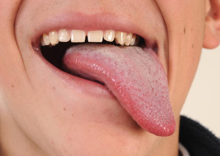 A person sticking their tongue out.