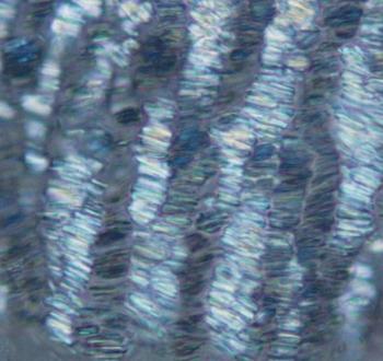 Small fragments of tissue containing orderly crystal deposits found in synovial fluid samples from asymptomatic gouty joints