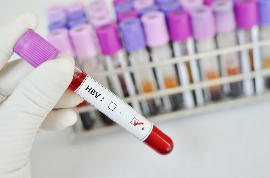 анализ крови на ЗППП гепатит В