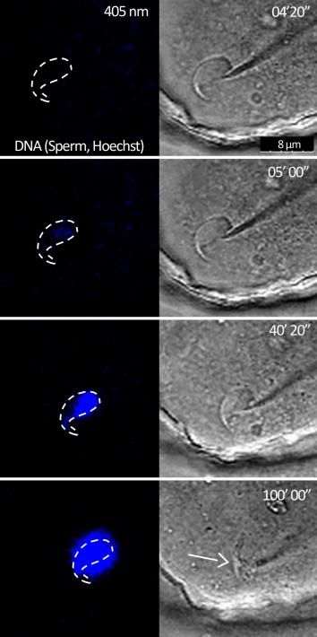 sperm fusing with egg