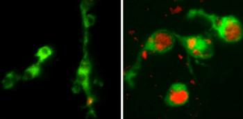 Macrophages
