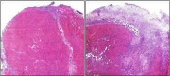 Healing With and Without Type 2 Helper T Cells