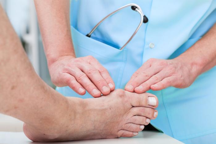 Bunions: Causes, symptoms, and treatment