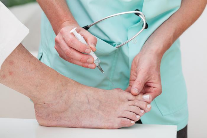 Bunions: Causes, symptoms, and treatment