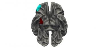 conduct disorder brain pattern