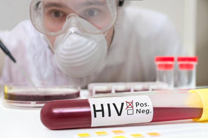 A doctor with a positive HIV blood sample.