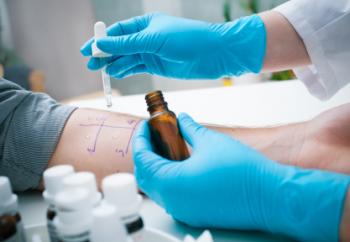 skin-prick test
