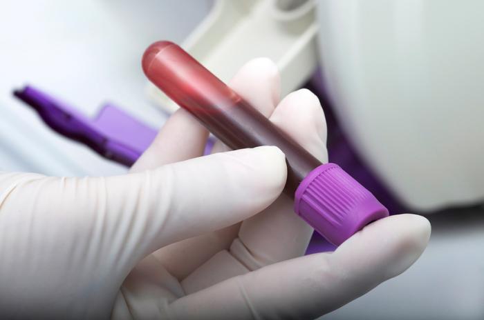 A hand holds a test tube of blood.