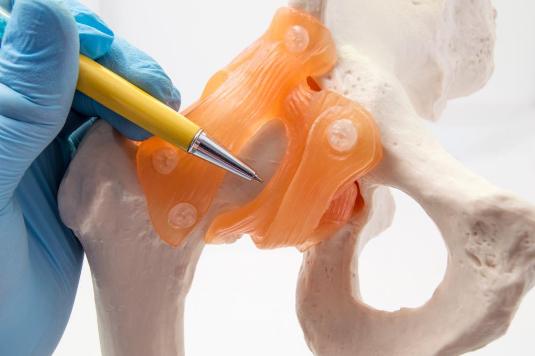 hip dysplasia