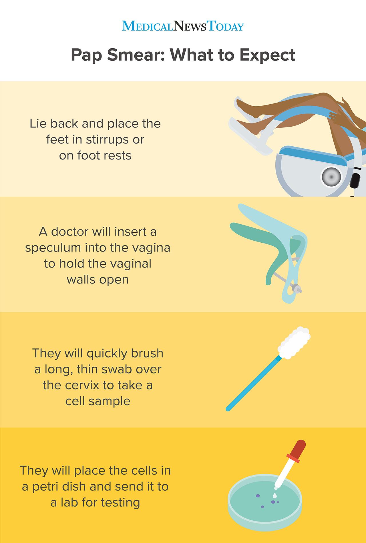 an infographic showing what to expect during a pap smear