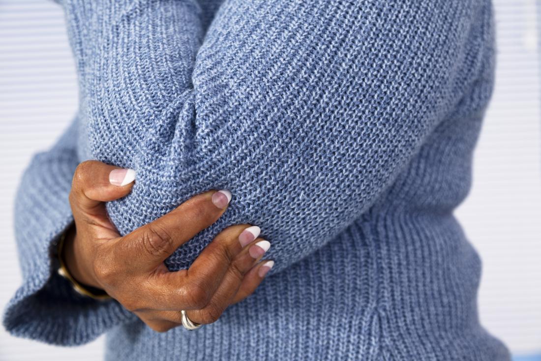 Woman with weakness and tingling due to spondylosis.