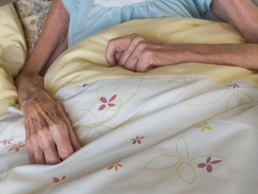 Older woman with marasmus.