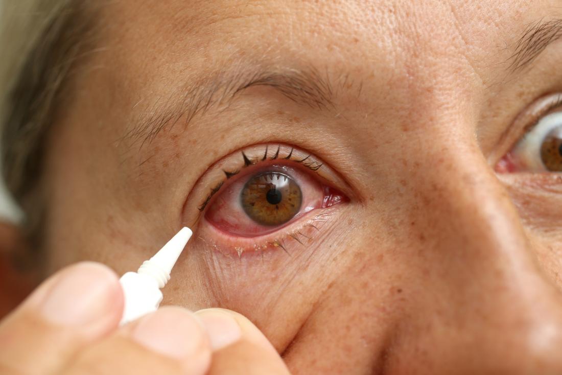 Read Insights about 7 Most Common Eye Injuries from Auckland Eye
