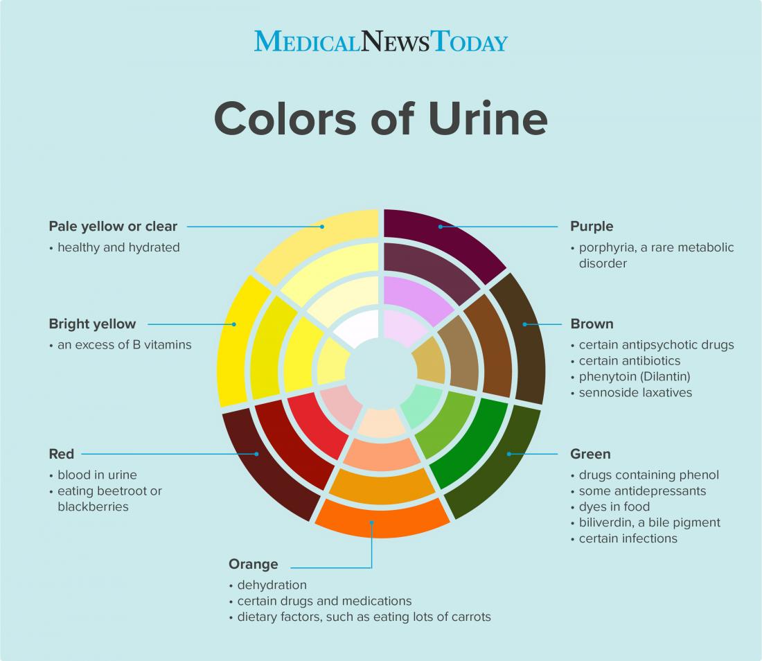 abnormal urine color