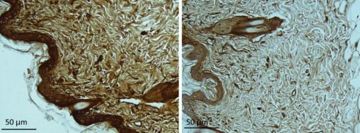 Image showing Huntingtin aggregates are elevated in skin sections from HD model mice
