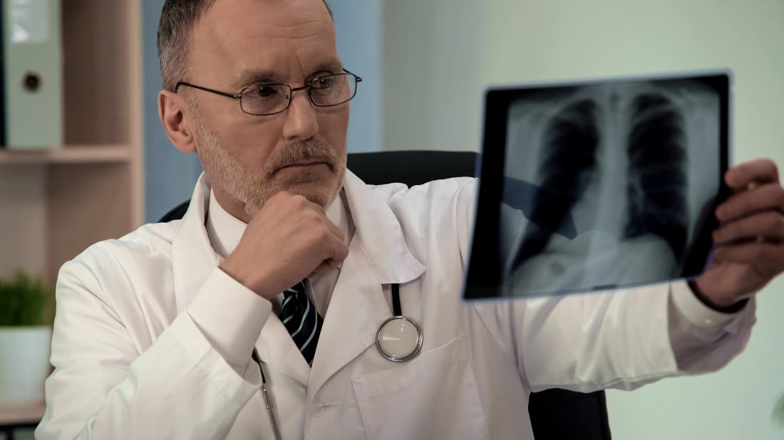 An x-ray is usually normal with CVA.