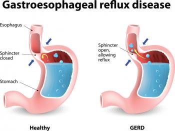 Infants with gerd