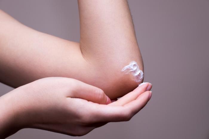 using moisturizing cream on an elbow