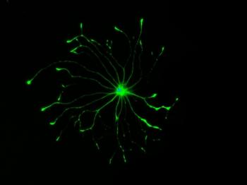 astrocyte